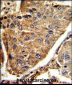 HEXA Antibody (Center)