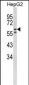 HEXA Antibody (Center)