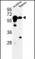 CBS Antibody (N-term)