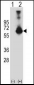 CBS Antibody (N-term)