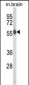 AKT2 Antibody