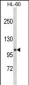 CASK Antibody (Center K227)