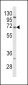 PCSK9 Antibody (N-term)