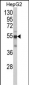 CYP2J2 Antibody (N-term)