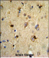 EN2 Antibody (C-term)