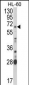 ARSB Antibody (Center)