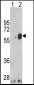 ARSB Antibody (Center)