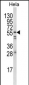 FYN Antibody (N-term)