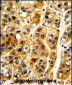 NFKBIA Antibody ( S32/36 )