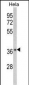 NFKBIA Antibody ( S32/36 )