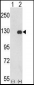 PTK2 Antibody (C-term)