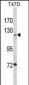 PTK2 Antibody (Center)