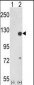 PTK2 Antibody (Center)