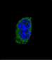 TSHB Antibody (Center)