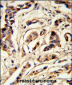 TSHB Antibody (Center)