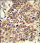 CAT Antibody (Center)