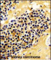 KLRC1 Antibody (C-term)
