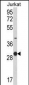 KLRC1 Antibody (C-term)