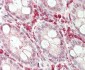 KLRC2 Antibody (N-term)