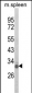 OLIG3 Antibody (Center)