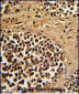 ESRRA Antibody (Center)