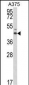 ESRRA Antibody (Center)