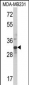 MLX Antibody (Center)