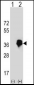 MLX Antibody (Center)