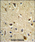 CYP2E1 Antibody (C-term)