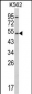 CYP2E1 Antibody (C-term)