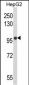 BANK1 Antibody (Center)