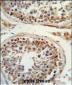 ITGB3 Antibody (C-term)