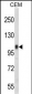 ITGB3 Antibody (C-term)