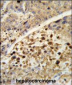 NR1I2 Antibody (Center)