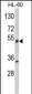 NR1I2 Antibody (Center)