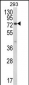 JAKMIP1 Antibody (Center)