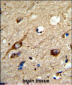 AGPAT3 Antibody (Center)