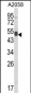 AGPAT3 Antibody (Center)