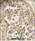 TBATA Antibody (C-term)