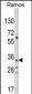 TBATA Antibody (C-term)