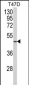 NCF1C Antibody (C-term)