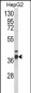 PECI Antibody (C-term)