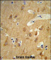 TSPAN12 Antibody (C-term)