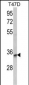 TSPAN12 Antibody (C-term)