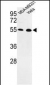 EGLN2 Antibody (Center)