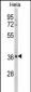 MDFIC Antibody (N-term)