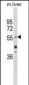 HNF1A Antibody (Center)