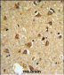 DIO2 Antibody (Center)