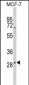 DIO2 Antibody (Center)