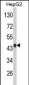 VPS26A Antibody (Center)